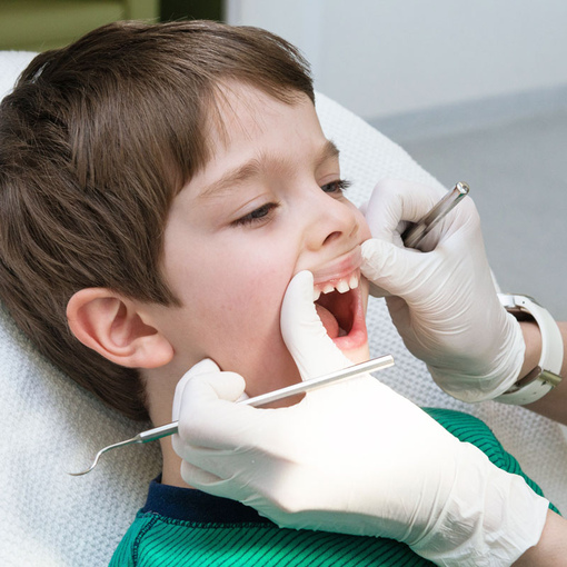 Восстановление сломанных зубов <br>у ребенка в Клинике Здоровья Исток